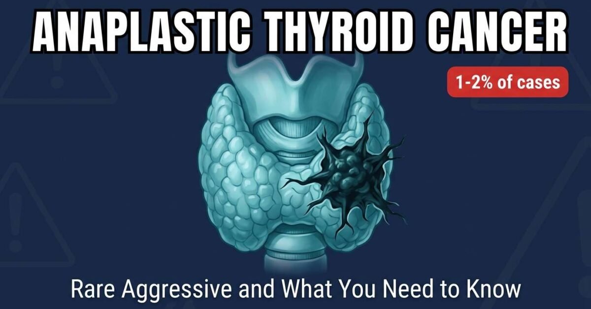 Anaplastic thyroid cancer overview showing aggressive tumour mass extending beyond the thyroid gland capsule